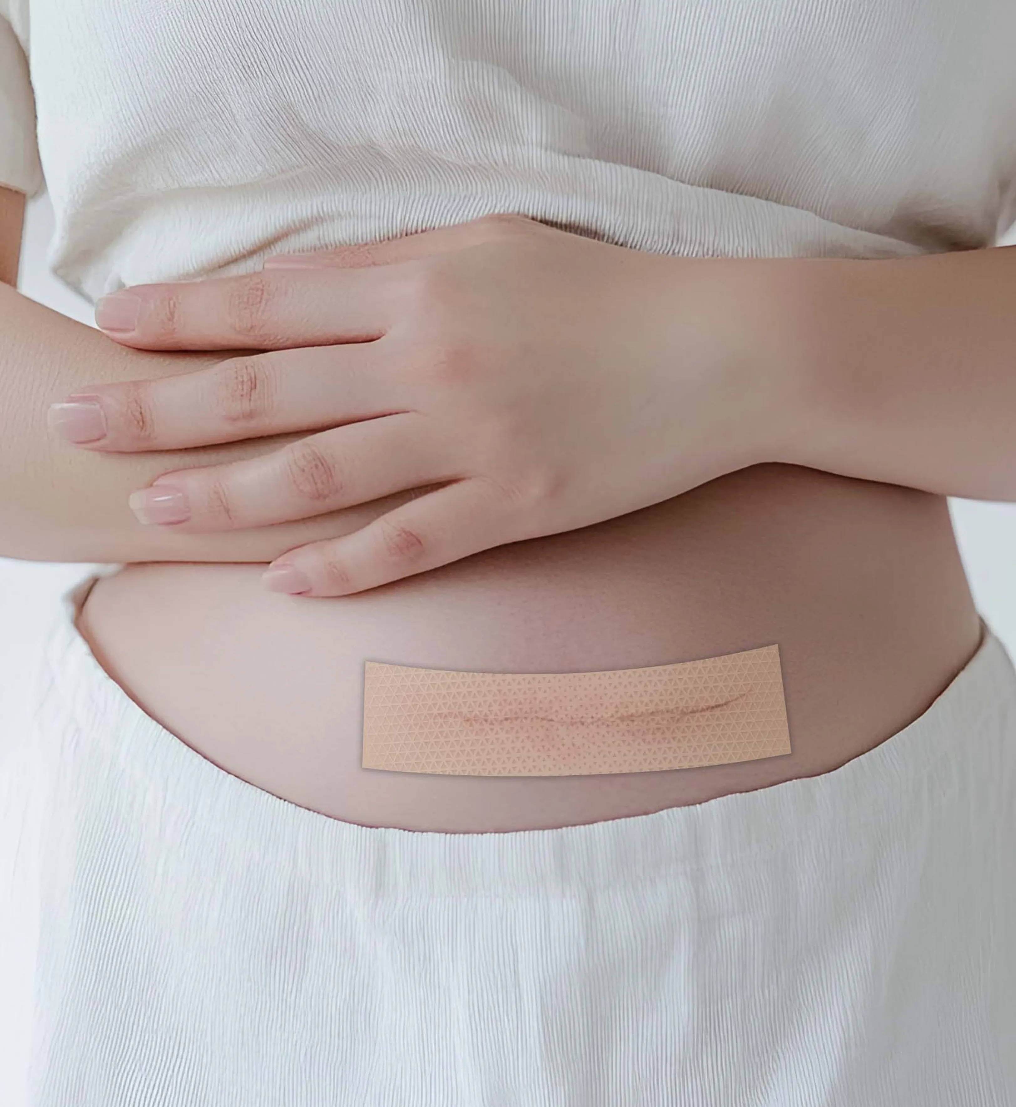 Professional Silicone Scar Care for Surgery, Trauma & Acne