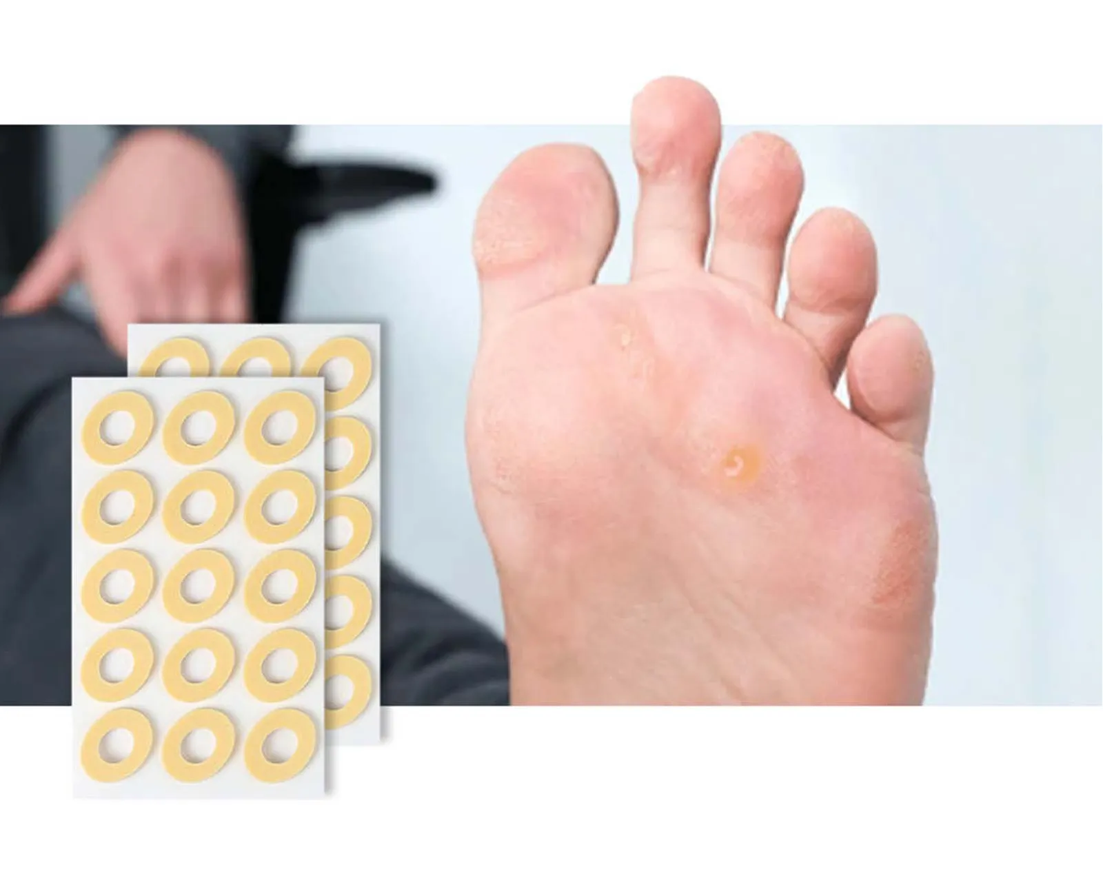Corn Remover Plasters