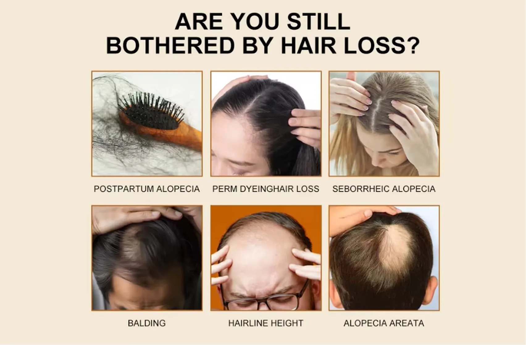 Are You Still Bothered By Hair Loss?