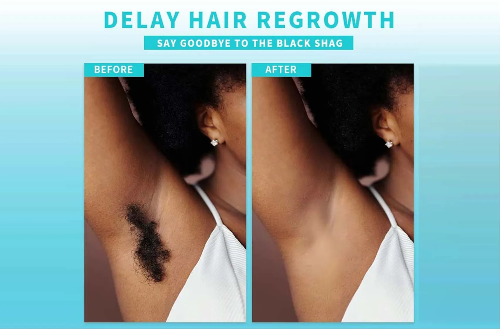 Delay Hair Regrowth