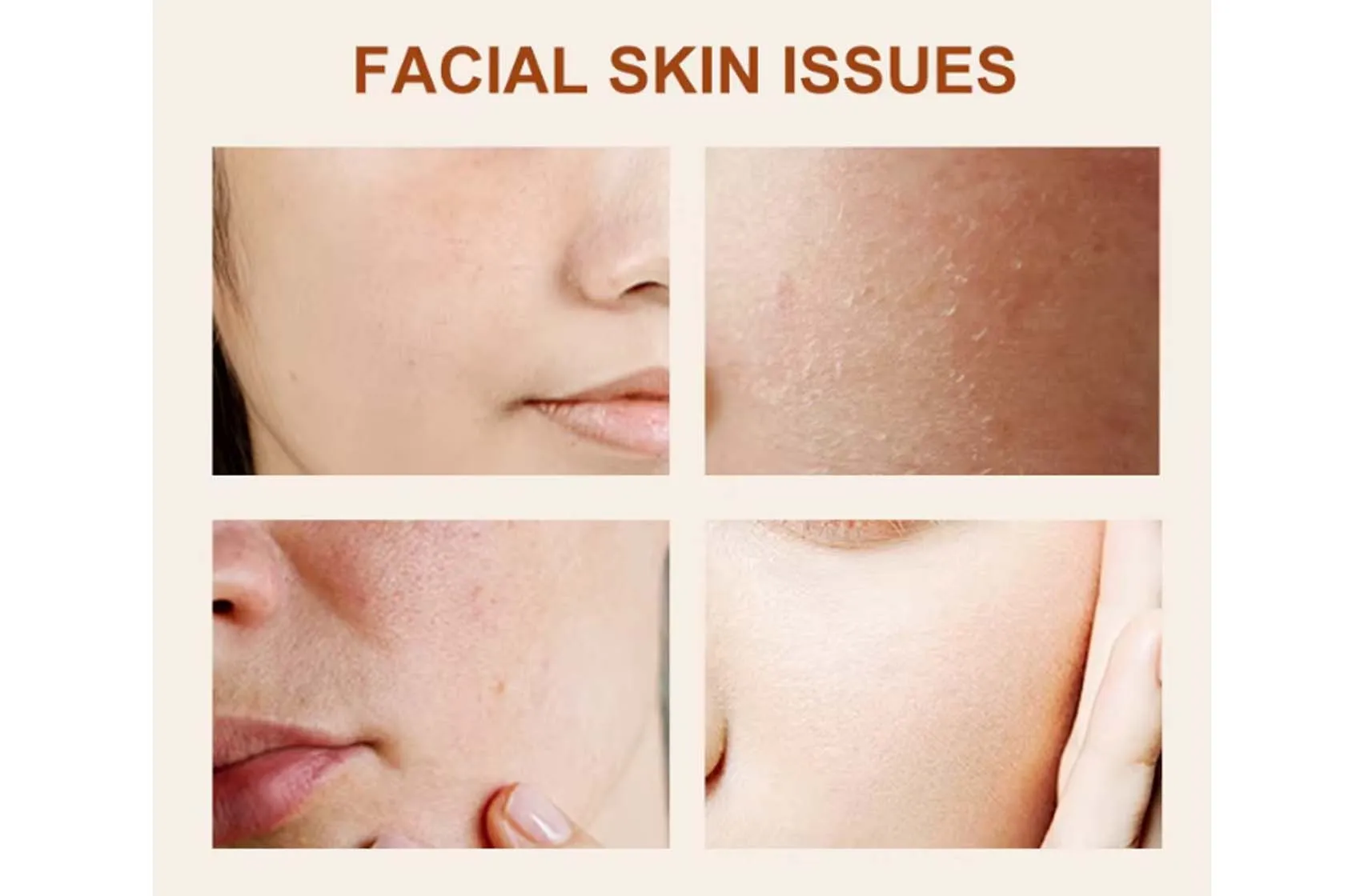 Facial Skin Issue
