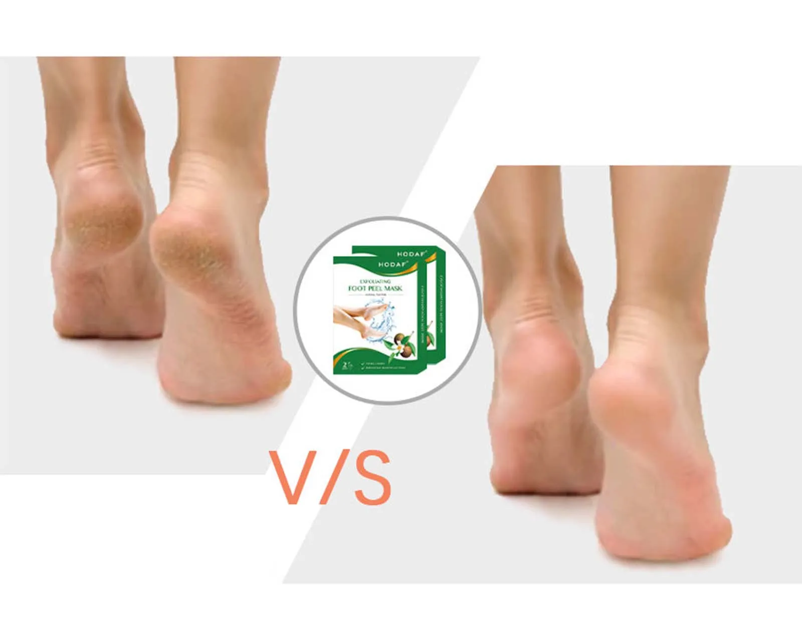 Moisturizing Foot Mask